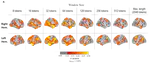 Incremental Accumulation of Linguistic Context in Artificial and Biological Neural Networks
